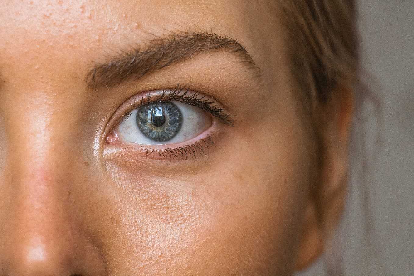 Närbild av ett blått öga med lätt rodnad och tecken på irritation. Vanliga ögonbesvär inkluderar torra ögon, allergier och ögoninflammation. Läs mer om orsaker, symtom och behandling av ögonproblem på Doktera.